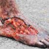 foot